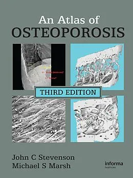 E-Book (epub) An Atlas of Osteoporosis von John C. Stevenson, Michael S. Marsh
