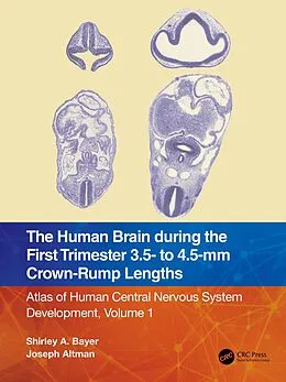 PDF The Human Brain during the First Trimester 3.5- to 4.5-mm Crown-Rump Lengths von Shirley A. Bayer, Joseph Altman