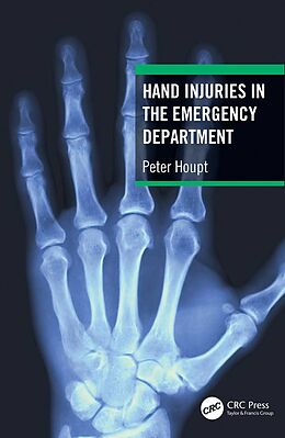 eBook (epub) Hand Injuries in the Emergency Department de Peter Houpt