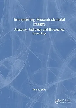 E-Book (pdf) Interpreting Musculoskeletal Images von Rosie Jones
