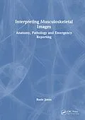 E-Book (epub) Interpreting Musculoskeletal Images von Rosie Jones