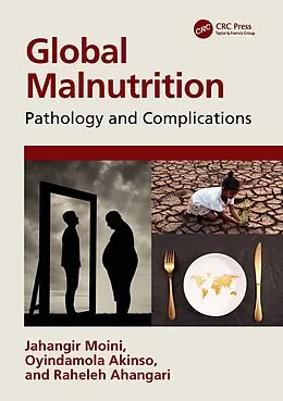 E-Book (epub) Global Malnutrition von Jahangir Moini, Oyindamola Akinso, Raheleh Ahangari