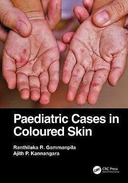 E-Book (epub) Paediatric Cases in Coloured Skin von Ranthilaka R. Gammanpila, Ajith P. Kannangara