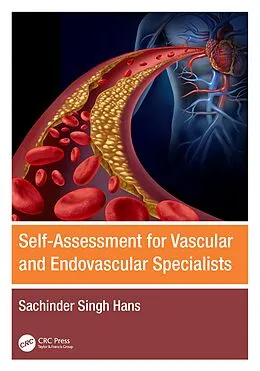 E-Book (pdf) Self-Assessment for Vascular and Endovascular Specialists von Sachinder Singh Hans