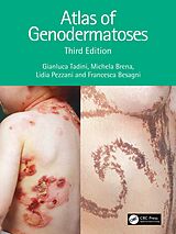 eBook (pdf) Atlas of Genodermatoses de Gianluca Tadini, Michela Brena, Francesca Besagni