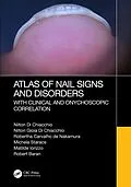 E-Book (pdf) Atlas of Nail Signs and Disorders with Clinical and Onychoscopic Correlation von Nilton Di Chiacchio, Nilton Gioia Di Chiacchio, Robertha Carvalho de Nakamura