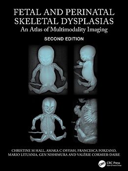 eBook (pdf) Fetal and Perinatal Skeletal Dysplasias de Christine M Hall, Amaka C Offiah, Francesca Forzano