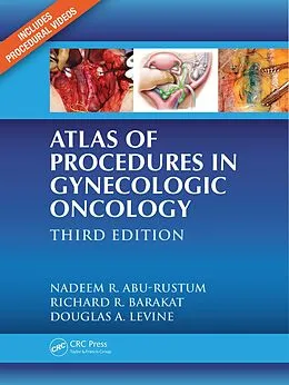 E-Book (epub) Atlas of Procedures in Gynecologic Oncology von Nadeem R. Abu-Rustum, Richard R. Barakat, Douglas A. Levine