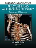 E-Book (epub) Forensic Pathology of Fractures and Mechanisms of Injury von Michael P. Burke