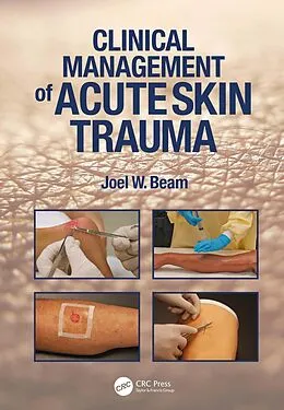 E-Book (epub) Clinical Management of Acute Skin Trauma von Joel W. Beam