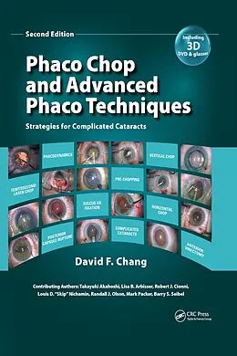 ePUB Phaco Chop and Advanced Phaco Techniques von David F. Chang