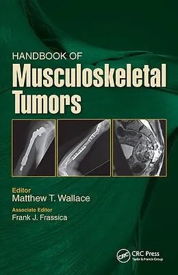 E-Book (epub) Handbook of Musculoskeletal Tumors von Matthew Wallace, Frank Frassica