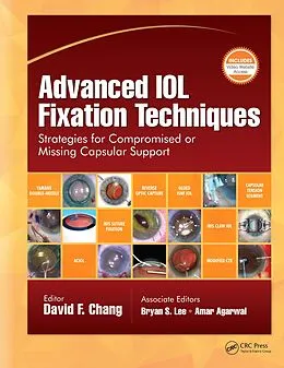 E-Book (pdf) Advanced IOL Fixation Techniques von David F. Chang