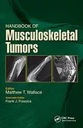 E-Book (pdf) Handbook of Musculoskeletal Tumors von Matthew Wallace, Frank Frassica