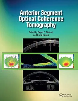 E-Book (pdf) Anterior Segment Optical Coherence Tomography von Roger Steinert, David Huang