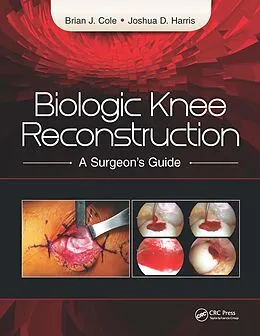 E-Book (pdf) Biologic Knee Reconstruction von Brian Cole, Joshua Harris