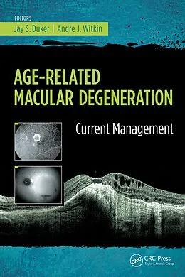 PDF Age-Related Macular Degeneration von Jay Duker, Andre Witkin