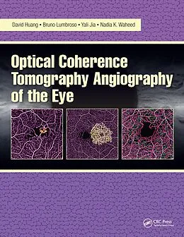 E-Book (pdf) Optical Coherence Tomography Angiography of the Eye von David Huang, Bruno Lumbroso, Yali Jia