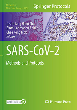 Couverture cartonnée SARS-CoV-2 de 