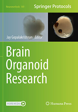 Couverture cartonnée Brain Organoid Research de 