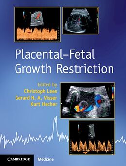 Fester Einband Placental-Fetal Growth Restriction von Christoph Lees, Gerard H. A. Visser, Kurt Hecher