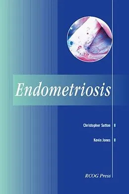 E-Book (pdf) Endometriosis von Christopher Sutton
