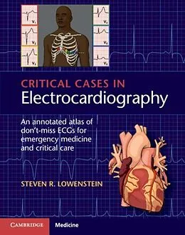 E-Book (pdf) Critical Cases in Electrocardiography von Steven R. Lowenstein