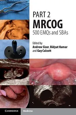 E-Book (pdf) Part 2 MRCOG: 500 EMQs and SBAs von Andrew Sizer