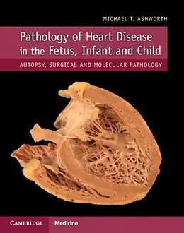 PDF Pathology of Heart Disease in the Fetus, Infant and Child von Michael T. Ashworth