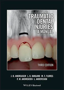 E-Book (epub) Traumatic Dental Injuries von Jens O. Andreasen, Leif K. Bakland, Maria Teresa Flores