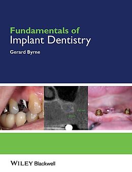 E-Book (pdf) Fundamentals of Implant Dentistry von Gerard Byrne