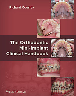 E-Book (epub) Orthodontic Mini-implant Clinical Handbook von Richard Cousley
