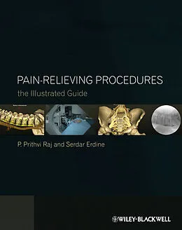 E-Book (pdf) Pain-Relieving Procedures von P. Prithvi Raj, Serdar Erdine