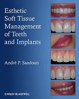 E-Book (epub) Esthetic Soft Tissue Management of Teeth and Implants von Andre P. Saadoun