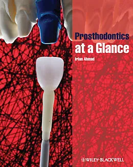 E-Book (pdf) Prosthodontics at a Glance von Irfan Ahmad
