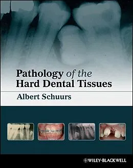 E-Book (epub) Pathology of the Hard Dental Tissues von Albert Schuurs