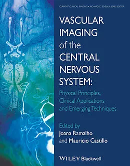 E-Book (epub) Vascular Imaging of the Central Nervous System von Joana Ramalho, Mauricio Castillo
