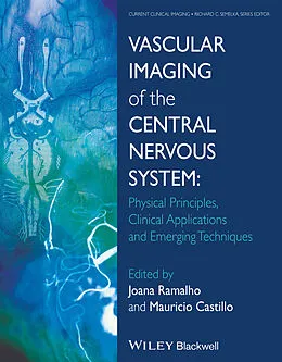 E-Book (pdf) Vascular Imaging of the Central Nervous System von Joana Ramalho, Mauricio Castillo