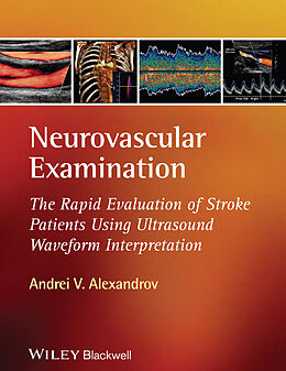 eBook (epub) Neurovascular Examination de Andrei V. Alexandrov