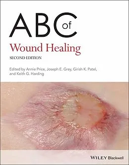 E-Book (epub) ABC of Wound Healing von 