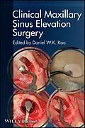 E-Book (epub) Clinical Maxillary Sinus Elevation Surgery von