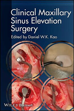 eBook (epub) Clinical Maxillary Sinus Elevation Surgery de 