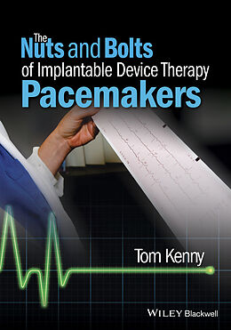 E-Book (pdf) The Nuts and Bolts of Implantable Device Therapy von Tom Kenny