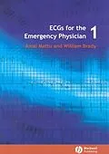 E-Book (pdf) ECGs for the Emergency Physician 1 von Amal Mattu