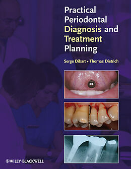 eBook (epub) Practical Periodontal Diagnosis and Treatment Planning de Serge Dibart