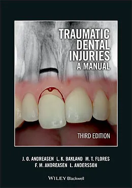 eBook (pdf) Traumatic Dental Injuries de Jens O. Andreasen, Leif K. Bakland, Maria Teresa Flores