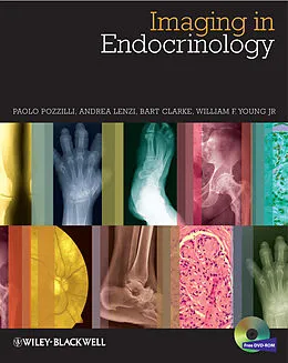 E-Book (epub) Imaging in Endocrinology von Paolo Pozzilli, Andrea Lenzi, Bart L. Clarke