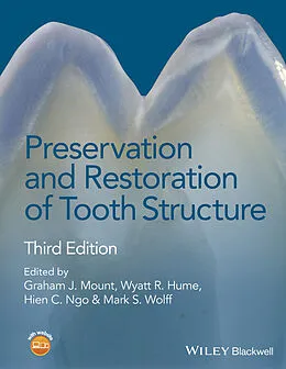 E-Book (pdf) Preservation and Restoration of Tooth Structure von 