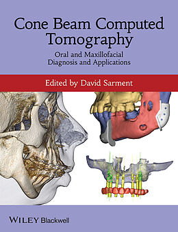 eBook (pdf) Cone Beam Computed Tomography de 