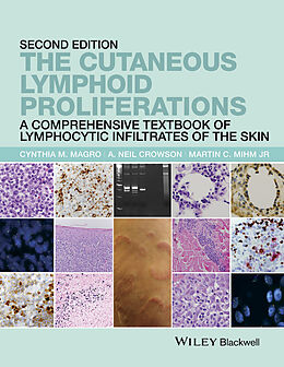 E-Book (epub) Cutaneous Lymphoid Proliferations von Cynthia M. Magro, A. Neil Crowson, Martin C. Mihm